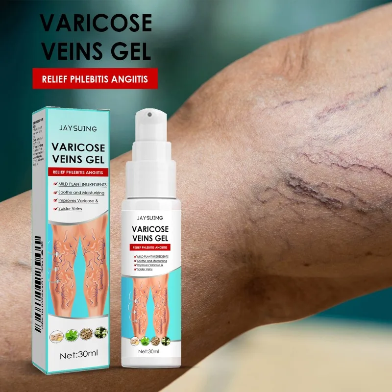 Varicose Veins Gel Phlebitis Worm Spider Legs Vessel Pain Professional Treatment Soothing Reduce Swelling Repair Cream