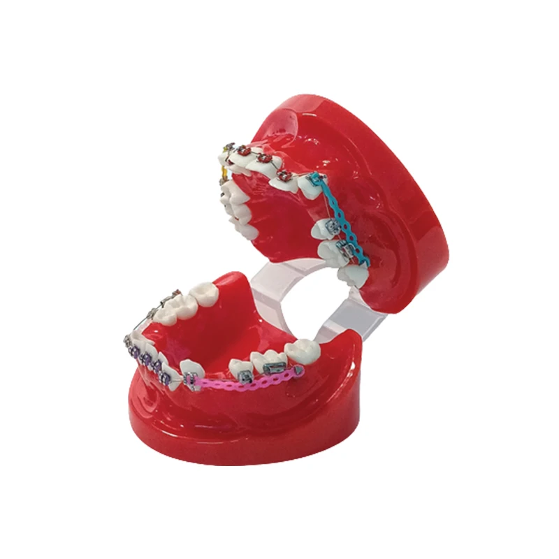 Dental Teaching Model with Buccal Tubes Oral Teeth Restoration Practice