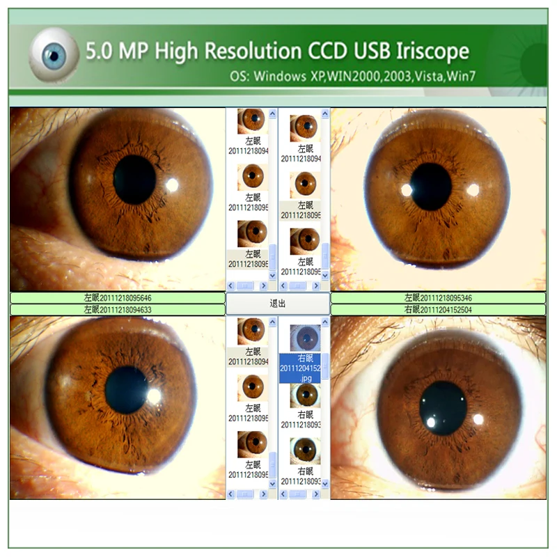 아이리스코프 iridology 카메라 프로 소프트웨어, 영어 아이리스 분석기