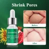 MABREM Pore Shrinking Serum Essence Pores Treatment Moisturizing Relieve Dryness Oil-Control Firming Repairing Smooth Skin Care 4