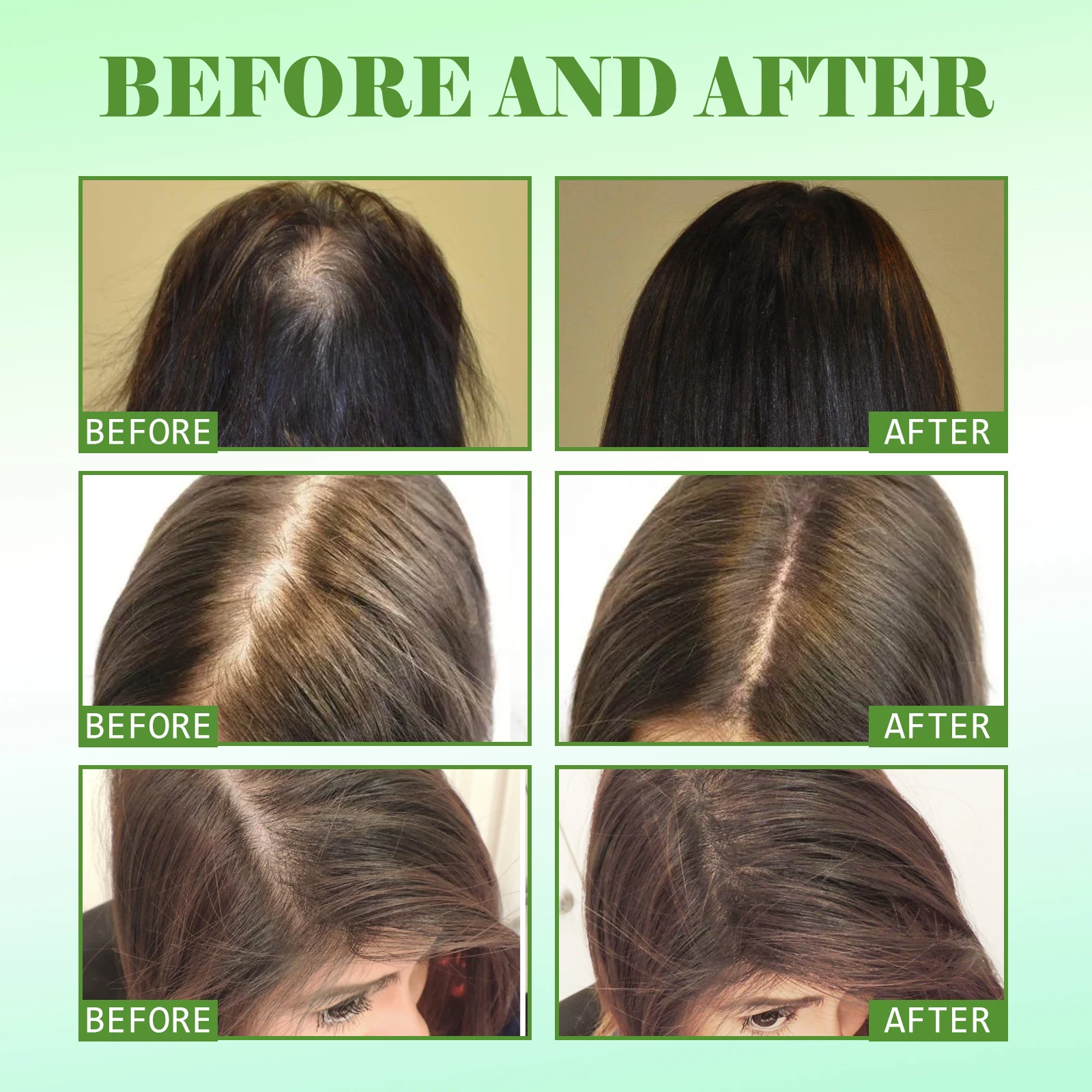 Rosemary Scalp Hair Essential Oil Softens Nourishes Hair Repairs Damage Prevents Loss And Nourishes Essence Oil