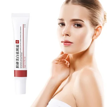 Efficace crema lentiggine schiarente veloce viso rimuovere Melasma macchia scura dissolvenza melanina sbiancare Anti-pigmentazione migliora l'ottusità 1
