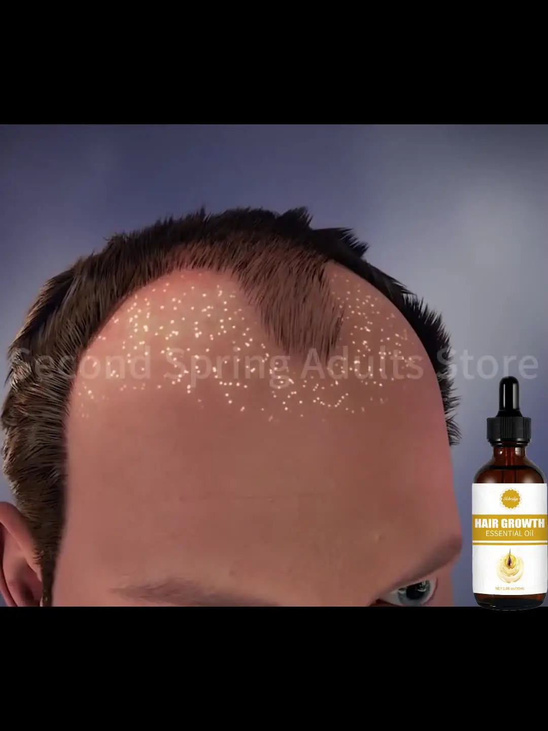 Dites Alfa a lɺmincissement descheveux au soin des cheveux à laréparation и la prevención deamincissement cheveuX