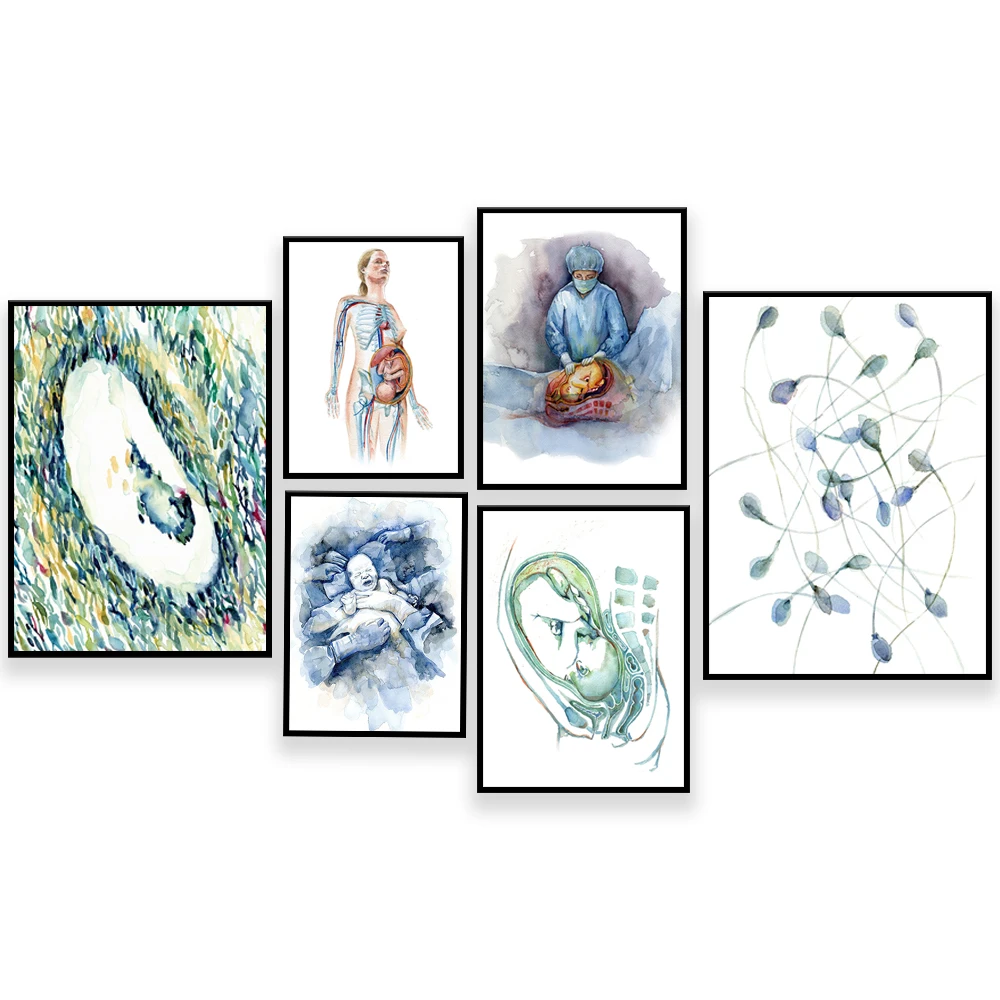 생리주기, 정자 인쇄, 제왕 절개 OBGYN 및 여성 생식 해부학, 초음파, 임신 수채화 포스터