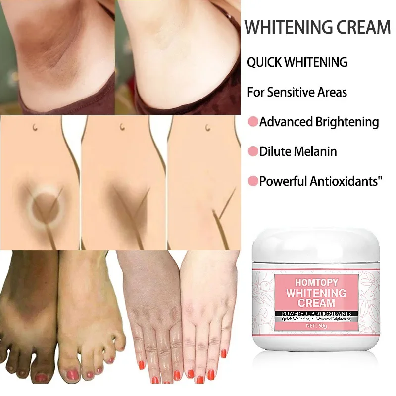 WHITENING CREAM BODY CREAM BODY WHITENING CREAM UNDERARM LEGS KNEE ELBOW PRIVATE PARTS