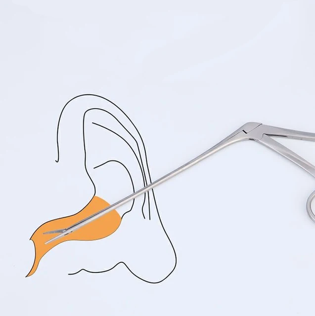 Pinze Per Orecchie Naso 5 Pinze Alligatore Per ORL - Strumenti Chirurgici Nasali, Anse Da 3,5 Mm, Nuove Tappi Orecchie - Foto 6