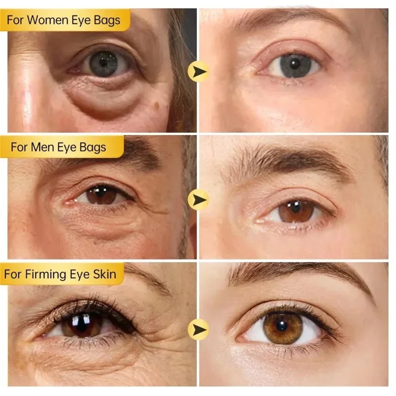 Instant Eye Bag Removal Cream Retinol Anti-Wrinkle Lifting Firming Fade Fine Lines Anti Dark Circle Puffiness Brighten Eye Care 2