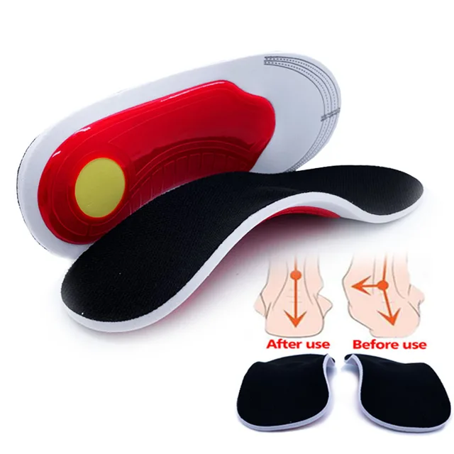 Insole Orthopedic X/O Leg Correction Arch Support Flat Foot Orthopedic Insole Men Relieve Air Movement High Elastic Cushion