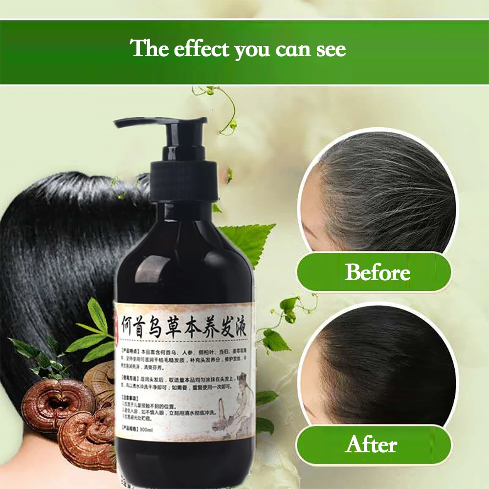 

Herbal Natural Polygonum Multiflorum Shampoo Plant Liquid Grey Hair White Hair Removal Turn Permanent Black Hair Care 300ml