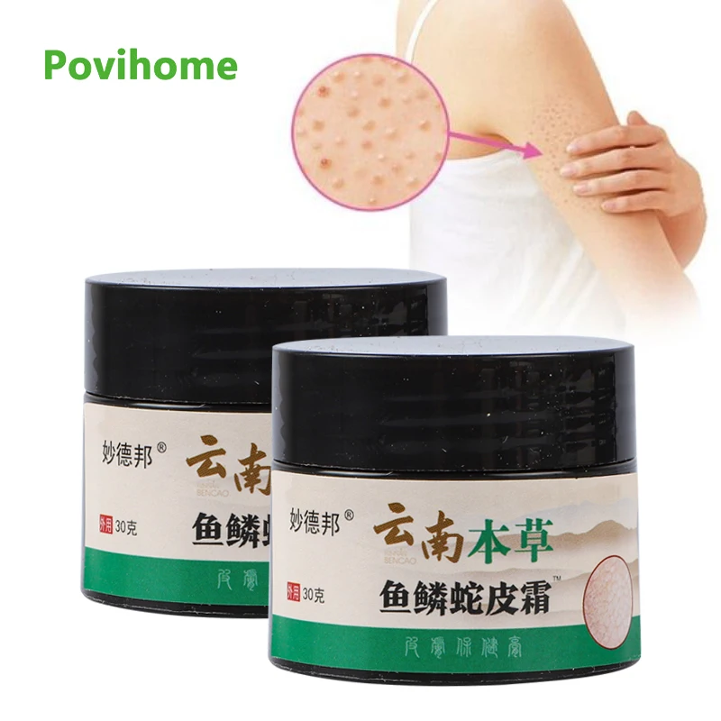 

30g Curing Keratosis Pilaris Chicken Skin Body Lotion Skin Repair Cream Skin Care Essence Moisturizing And Nourishing Ointment