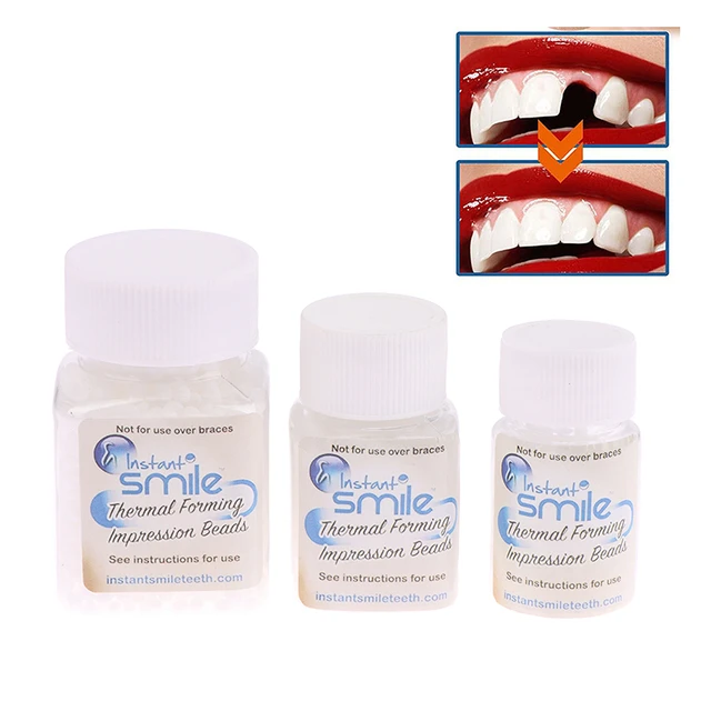 Temporary Tooth Repair Kit-Thermal Beads for Filling Nederland