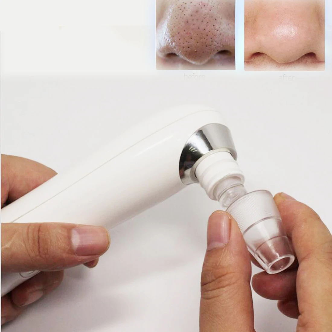 Pore Cleaner Black Head acne treatment Suction Extractor 1419 set facial and whitehead head electronic blackhead remover vacuum