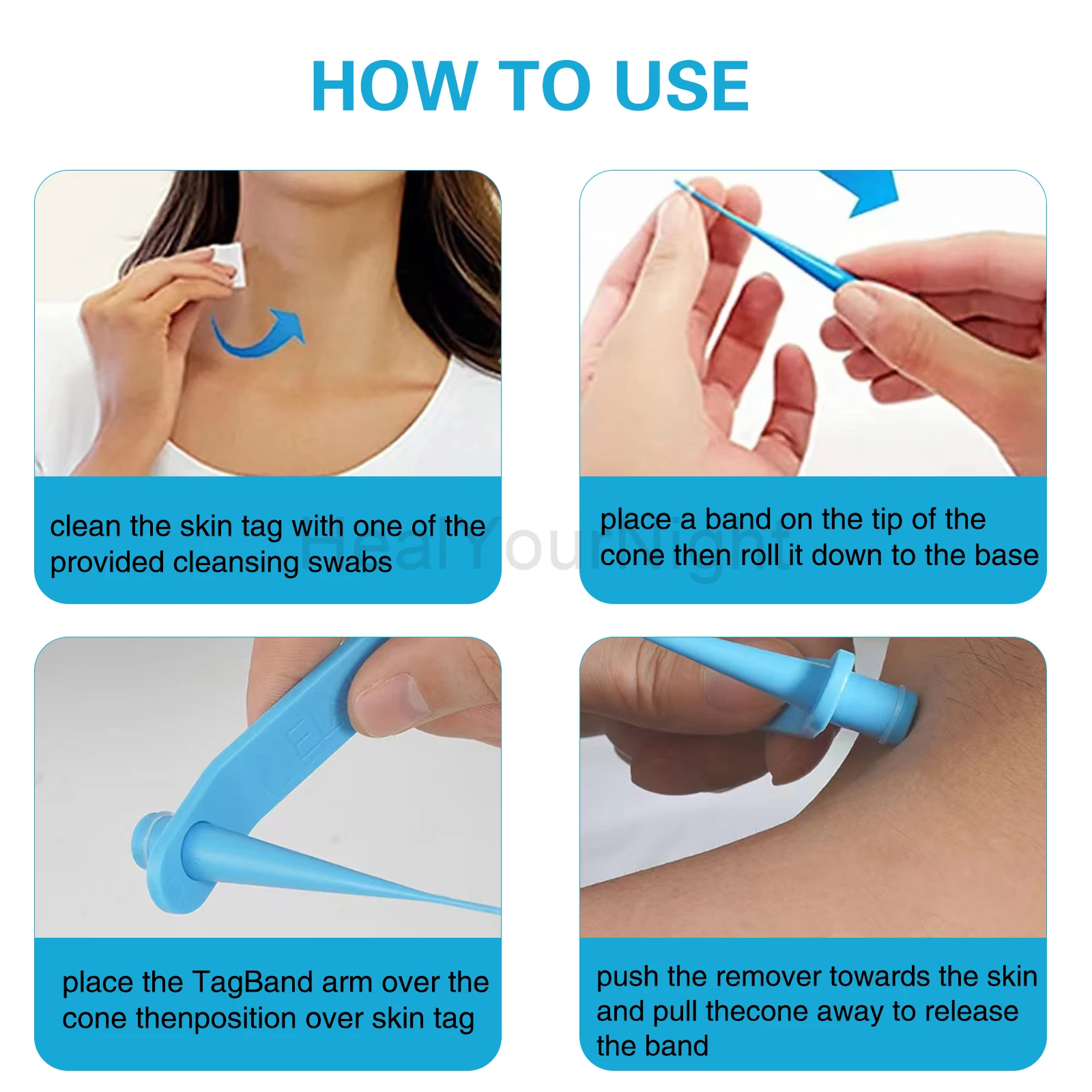 3-IN-1 Auto Skin Tag Removal Kit Painless Skin Label Mole Acne Wart Removal Pen Set with Cleansing Swabs Facial Beauty Care Tool 3