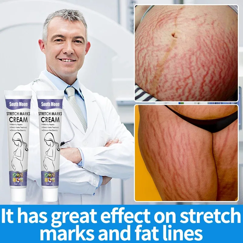 

Stretch Mark Permanent Remover Stretch Mark Removal Cream White Stretch Mark Remover Stretch Mark Remover Free Shipping