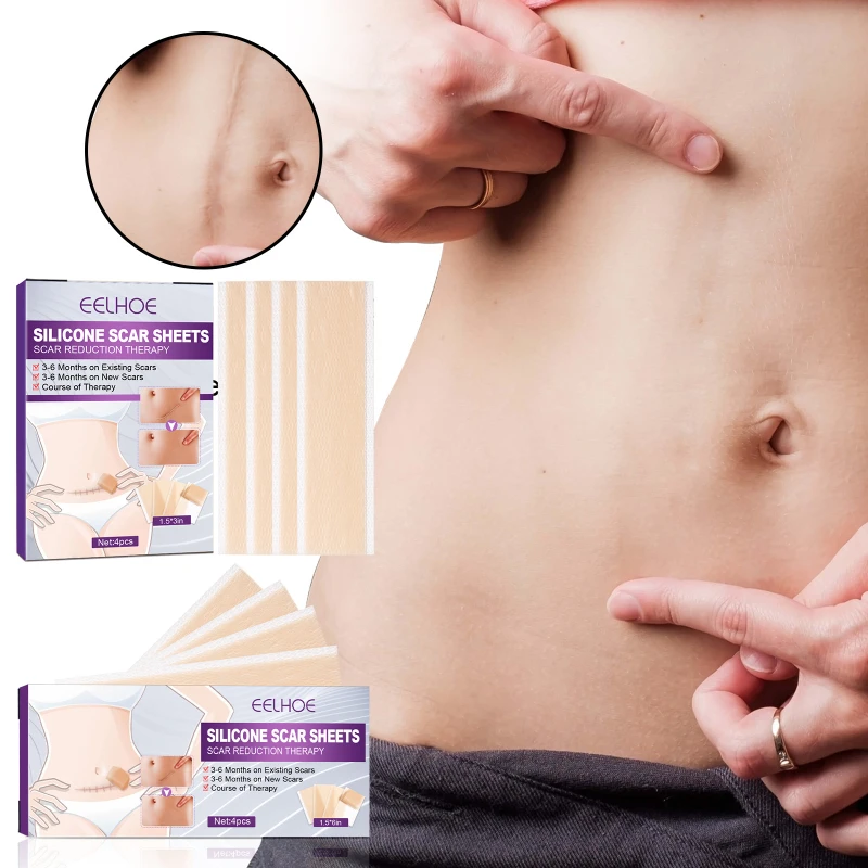 

Self-Adhesive Stickers for Scars Fade Remove Stretch Mark Burns Surgical Cesarean Section Hyperplasia Surgery Scar Removal Patch