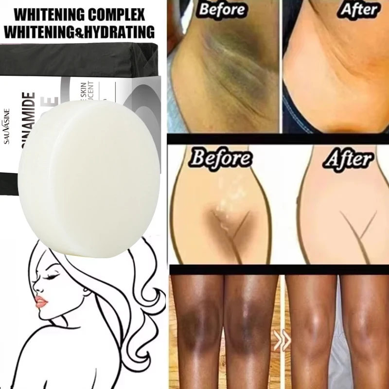 Body Whitening Soap Deep Clean Skin Chicken Skin Removal Soap Armpit Underarm Knees Bleaching Body Brighten White Care Products 3 Body Whitening Soap Deep Clean Skin Chicken Skin Removal Soap Armpit Underarm Knees Bleaching Body Brighten White Care Products 3