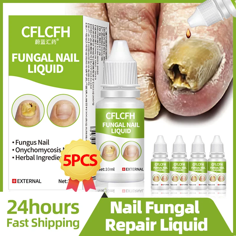 

Fungal Nail Repair Liquid Toe Fungus Removal Foot Care Onychomycosis Nail Treatment Cleaner Anti Infection Paronychia Solution