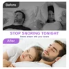 Anti-Snoring Nose Clip Nasal Breathing Dilators Sleep Explosion Bead Snore Stopper Increase Sports Air Intake Improve Sleeping 4