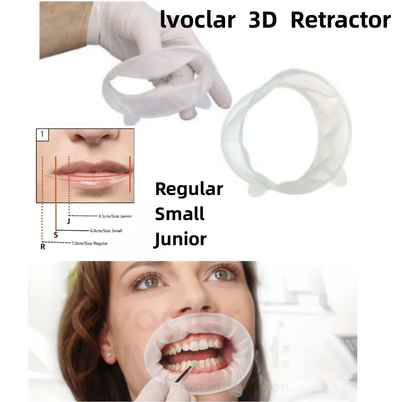 

OptraGate 3D Dental Mouth Opener Lip Cheek Retractor O Shape Regular Small Junior Ivoclar Vivadent Teeth Whitening