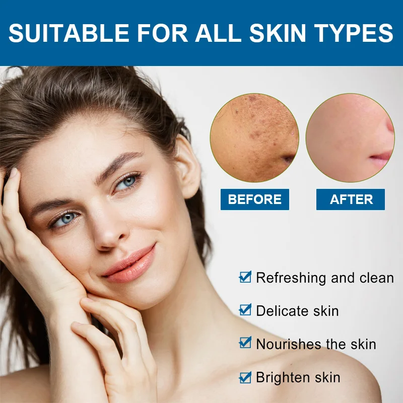 Oligopeptide Anti Acne Face Serum EGF Acne Treatment Essence Diminish Pigmentation Moisturizing Skincare Repair Skin Barrier 3