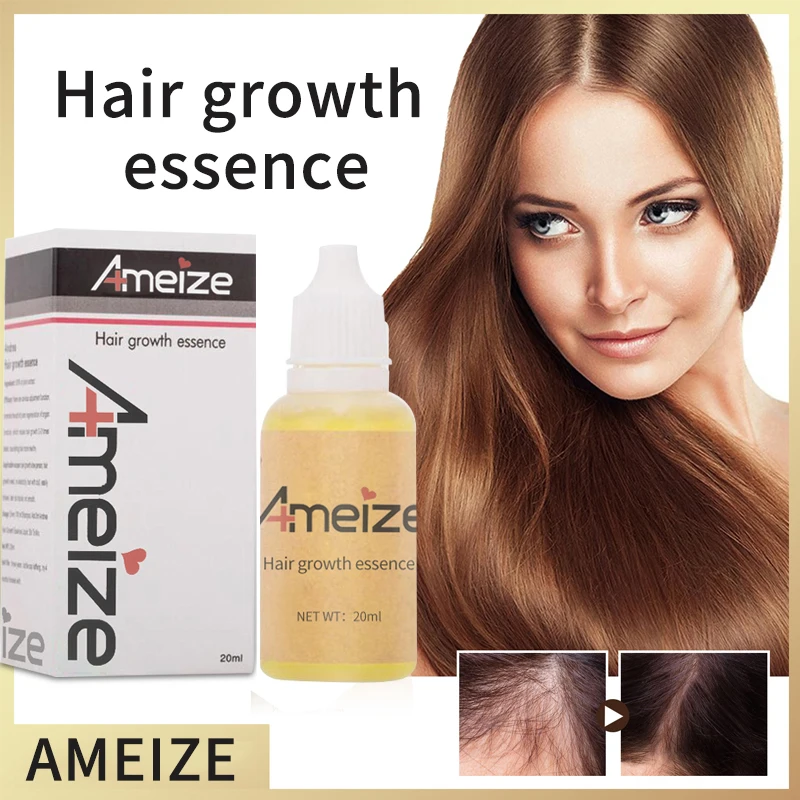 Hair Growth Essence Shampoo Mate 5Pcs Hair Regenerating Oil Reduce Loss Liquid 20ML