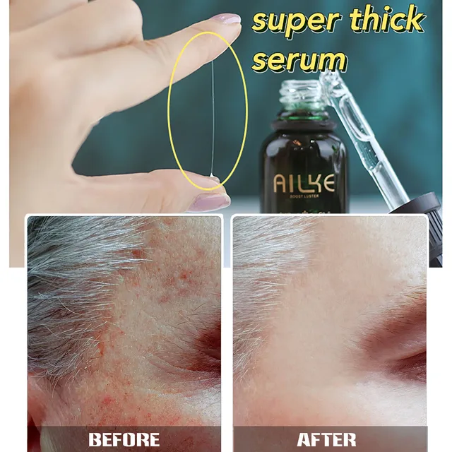 Ailke-Vitaminok C&E Előrehaladott 2% Retinoid Arc Szérum, Öregedésgátló Retinol Szérum A Bőr Ragyogására, Izzó, Hidratáló - Image 4
