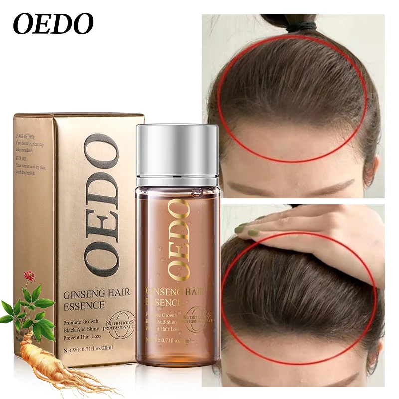 인삼 모발 재생 세럼 탈모 방지 건조 손상 강화 모발 영양 헤어 오일, 인삼 모발 재생