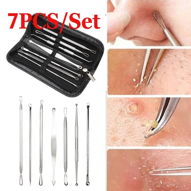 7/8Pcs Stainless Steel Blackhead Remover Tool Set Whitehead Pimple Spot Comedone Acne Extractor Remover Popper Face Tools Kit blackhead remover,acne remover,facial pore cleanser