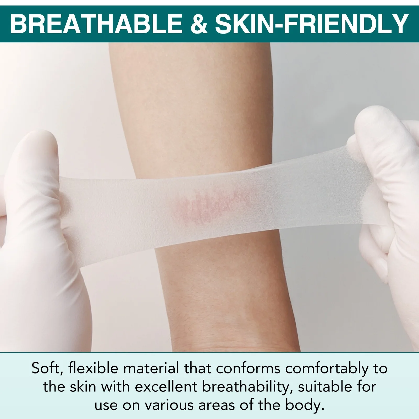 Advanced Skin-Friendly Hydrocolloid Healing Dressings - Soft, Anti-Infection, Customizable Roll