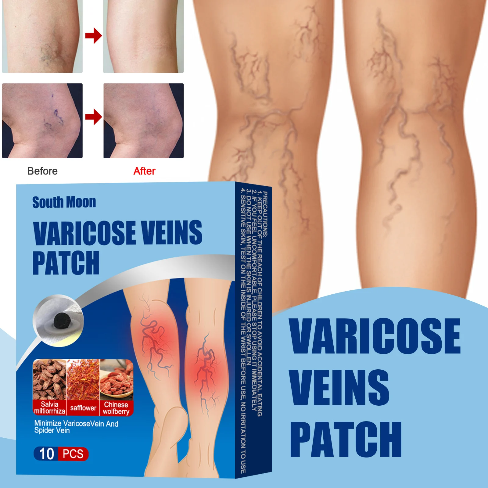 Newly Varicose Vein Plaster Intravenous Health Patch For Leg Pain newly-varicose-vein-plaster-intravenous-health-patch-for-leg-pain