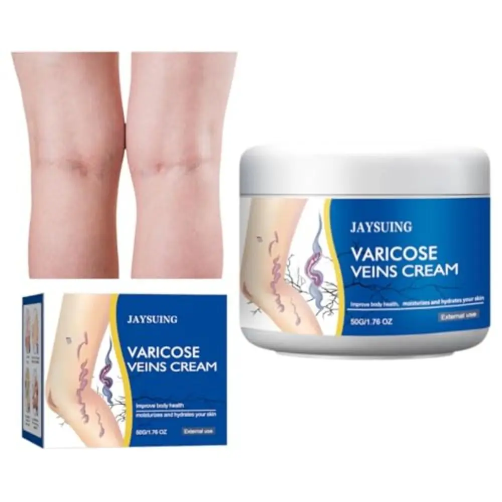 50g/1.76fl.oz Legs Varicose Veins Treatment Pain Relief Mild & Safe Legs Skin Cream Moisturizes The Skin