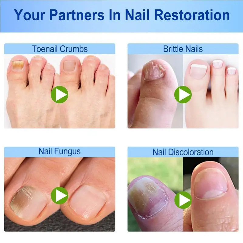 Toenail Patches Nail Repair Extra Strength Patches For Toenail Fingernail Non-Irritating And Breathable Nail Repair Renewal Nail Repair Toenail Fungus Patch Nail Problem Solving Foot Care Patches
