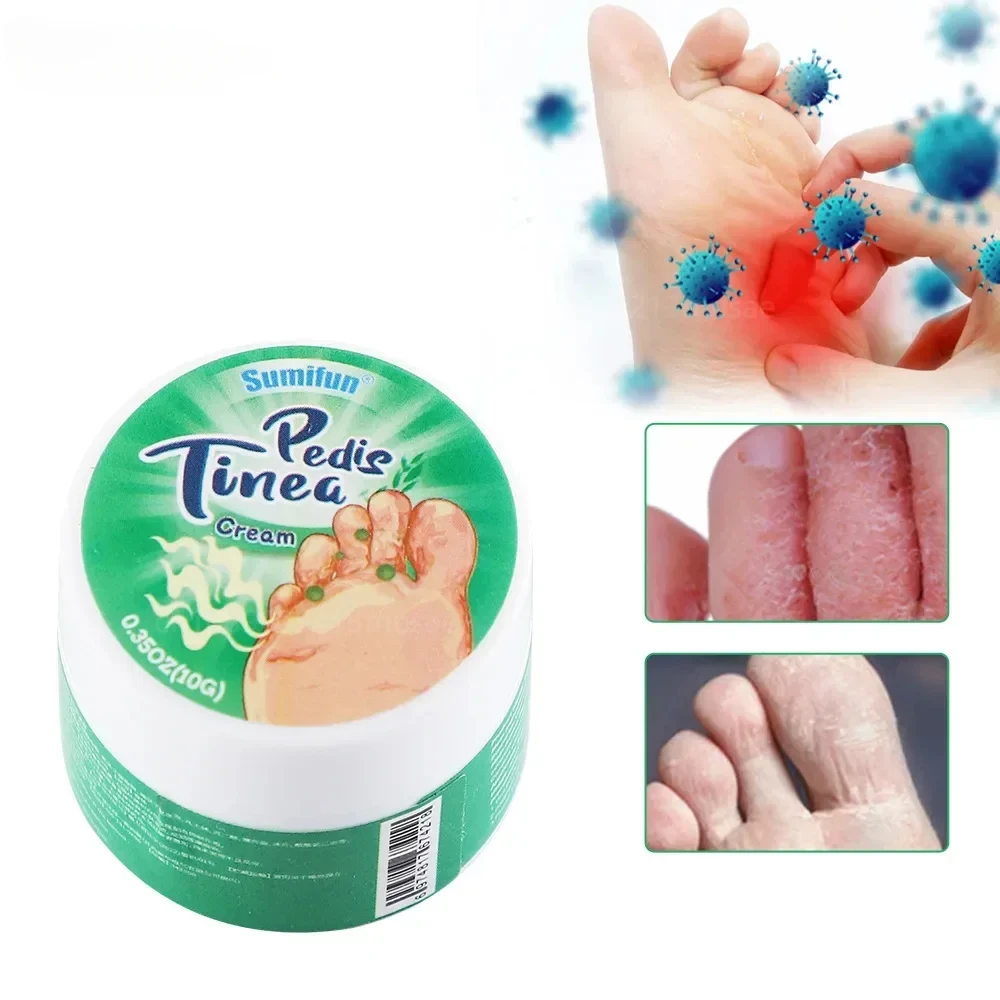 

Foot Fungus Removal Cream Relieve Foot Itching Remove Beriberi Dead Skin Foots Sweat Moisturize Repair Foot Cracked Ointment