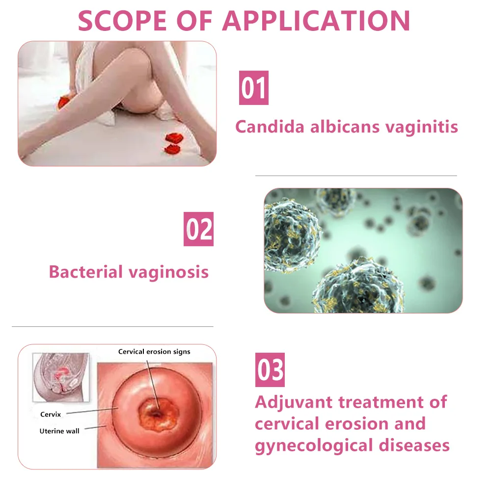 Chitosan Vaginal Antibacterial agina Clean Detox Improve The Symptoms Of Genital Itching Increased Vaginal Discharge Health Care