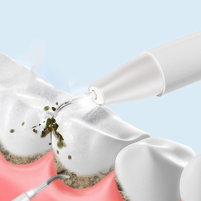 Description Picture 4 of itemDurable Portable Water Flosser Dental Cleaner Orals Irrigator for Effective PlaqueTartar Removal with 5 Adjustable Modes