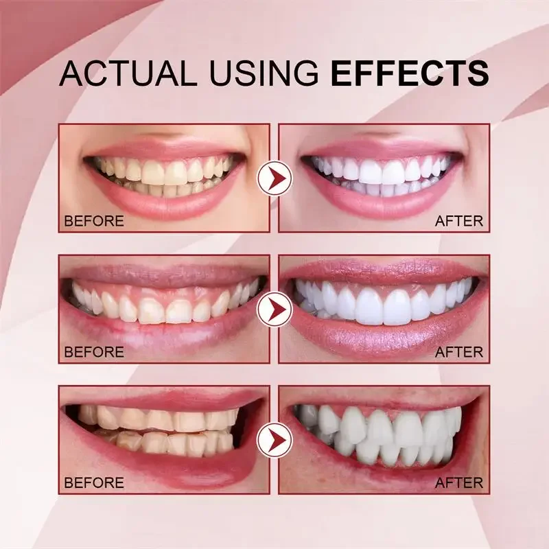 Probiotic Toothpaste Whiten Tooth Remove Plaque Stains Teeth Whitener Oral Hygiene Clean Fresh Breath Teeth Care Products,teeth whitening essence,teeth whitening product,teeth health product