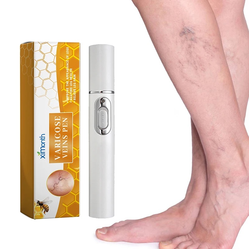 Lampshade Therapy Leg Repair Pen  Improving Blood Circulation Varicose Veins Relieves Leg Bulge Discomfort Pen Skin Care Product 2