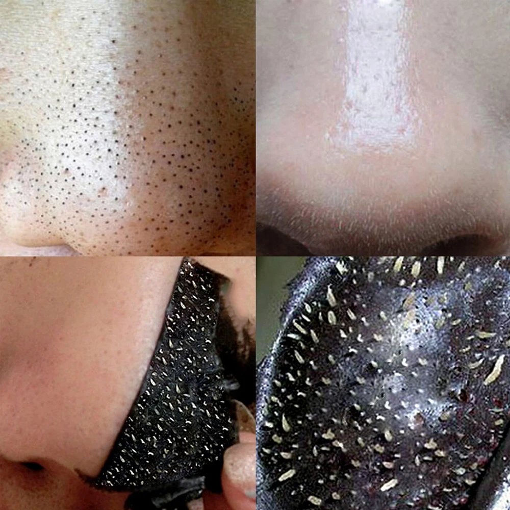 50pcs Nose Blackhead Remover Mask Deep Cleansing Skin Care Shrink Pore Acne Treatment Mask Nose Black Dots Pore Clean Strips