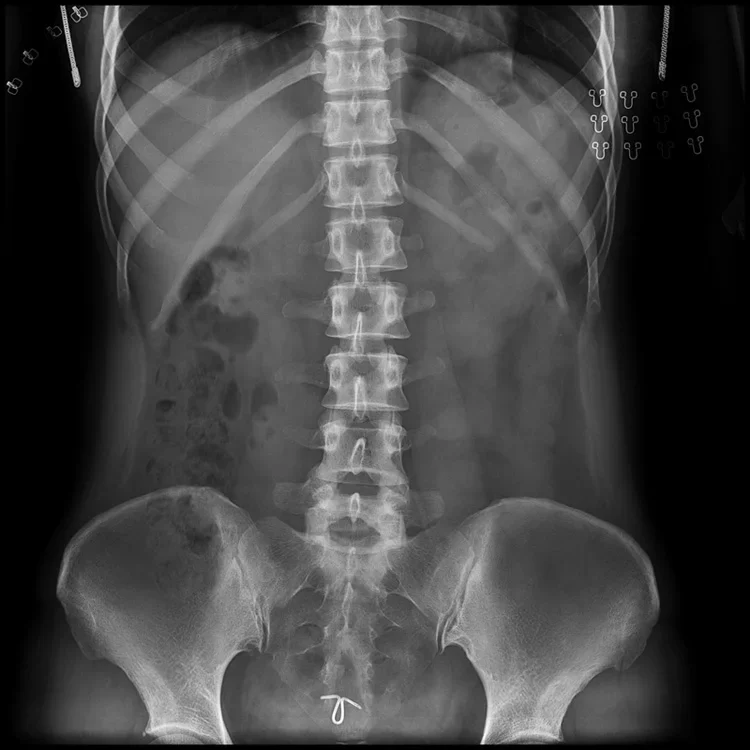 Рисунок 5 - Цифровой беспроводной рентгеновский