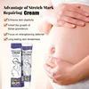 Stretch Mark Repair Cream – Smooth, Firm & Restore Skin Fast
