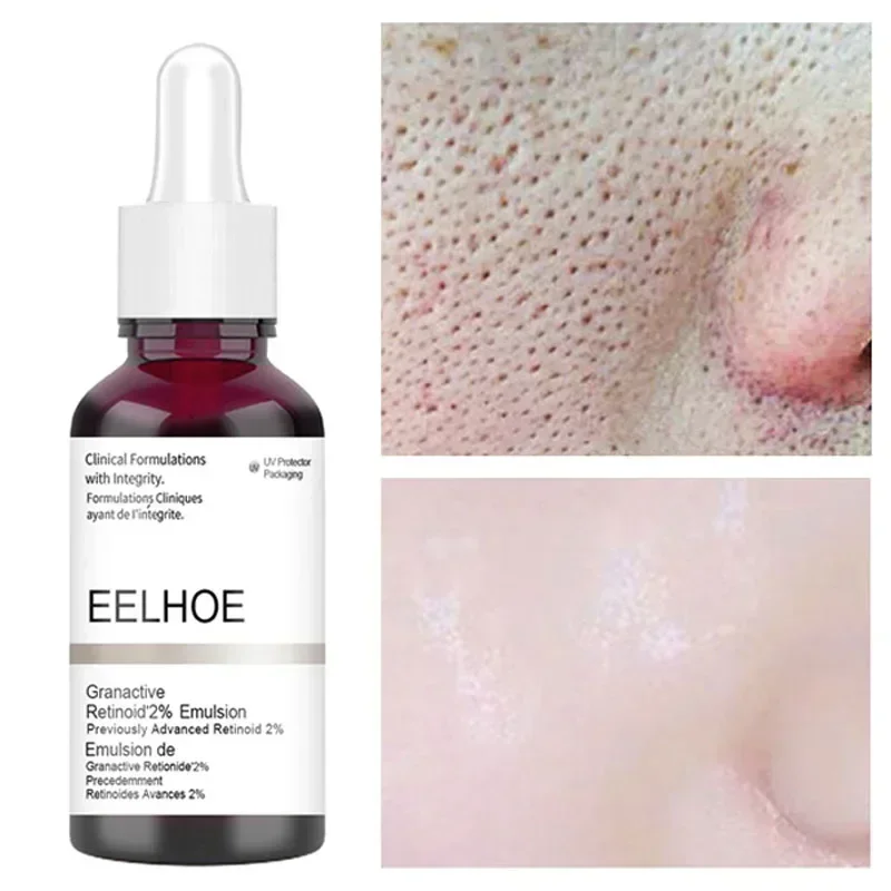 

Salicylic Acid Shrink Pores Serum Fruit Acid Exfoliating Nourish Moisturizing Smooth Pores Repair Essence Products Skin Care