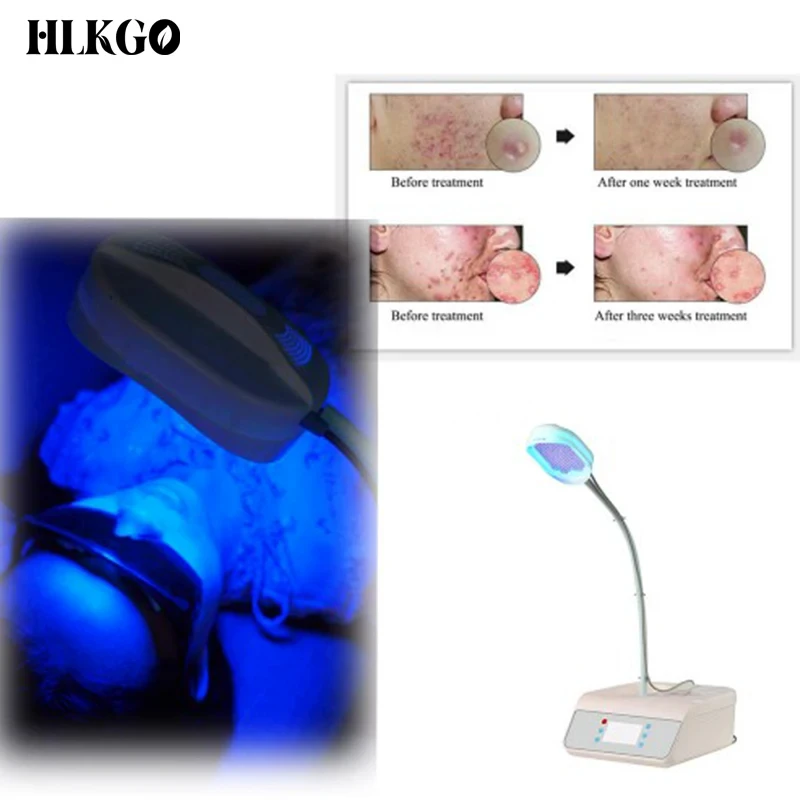 Rechargeable LED Facial Mask - 6 Light Modes for Anti-Aging, Acne Scars & Collagen Boosting