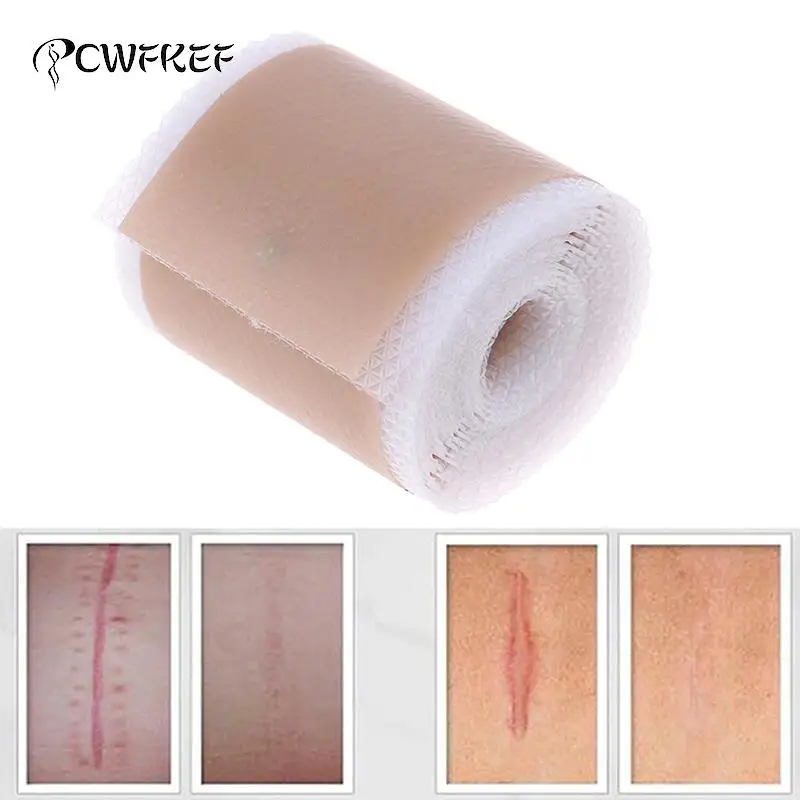 Efficient Surgery Scar Removal Silicone Gel Sheet Therapy Patch for Acne Trauma Burn Scar Skin Repair Treatment 4x150cm