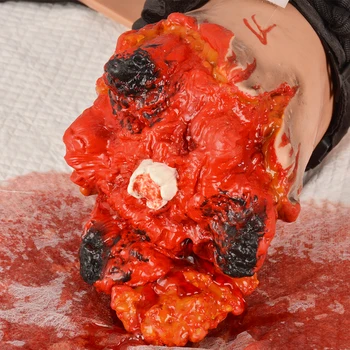 Broken Arm Hemostasis Training Model 1