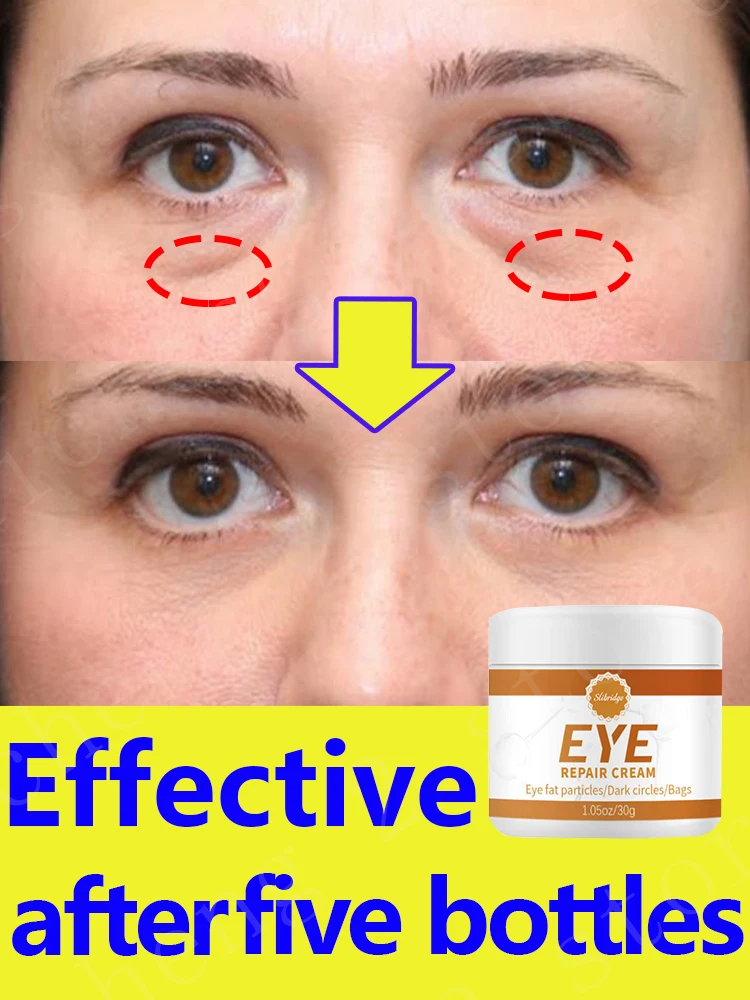 

Eye care cream