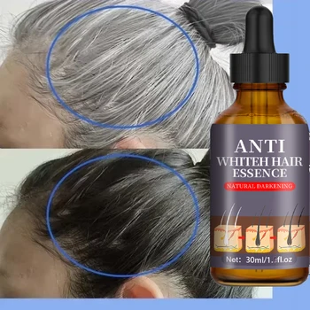 Siero Naturale Anti-Grigio per Capelli | Remedio Nutriente per la Cura dei Capelli - Ripara i Capelli Bianchi e Oscuranti