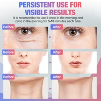 EMS Face Neck Lift Beauty Device Facial Massager LED Double Chin Remover Skin Rejuvenation Tightening Anti Wrinkle 6