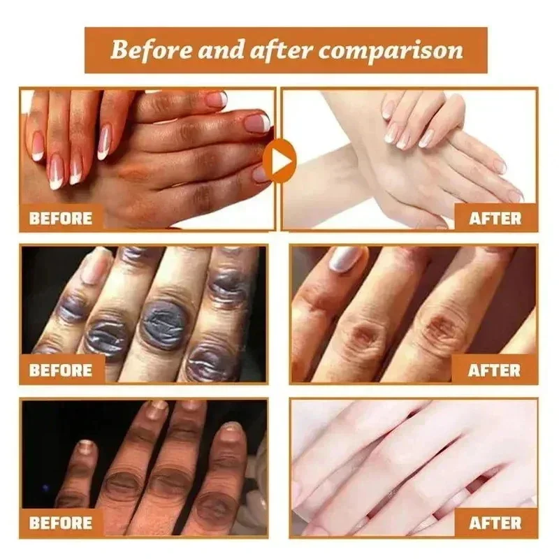 Dark Knuckles Fast Brighten Serum Elbows Hands Knee Armpits Brightening Serum Clarify Black Skin Lighten Stains Remover Essence 2