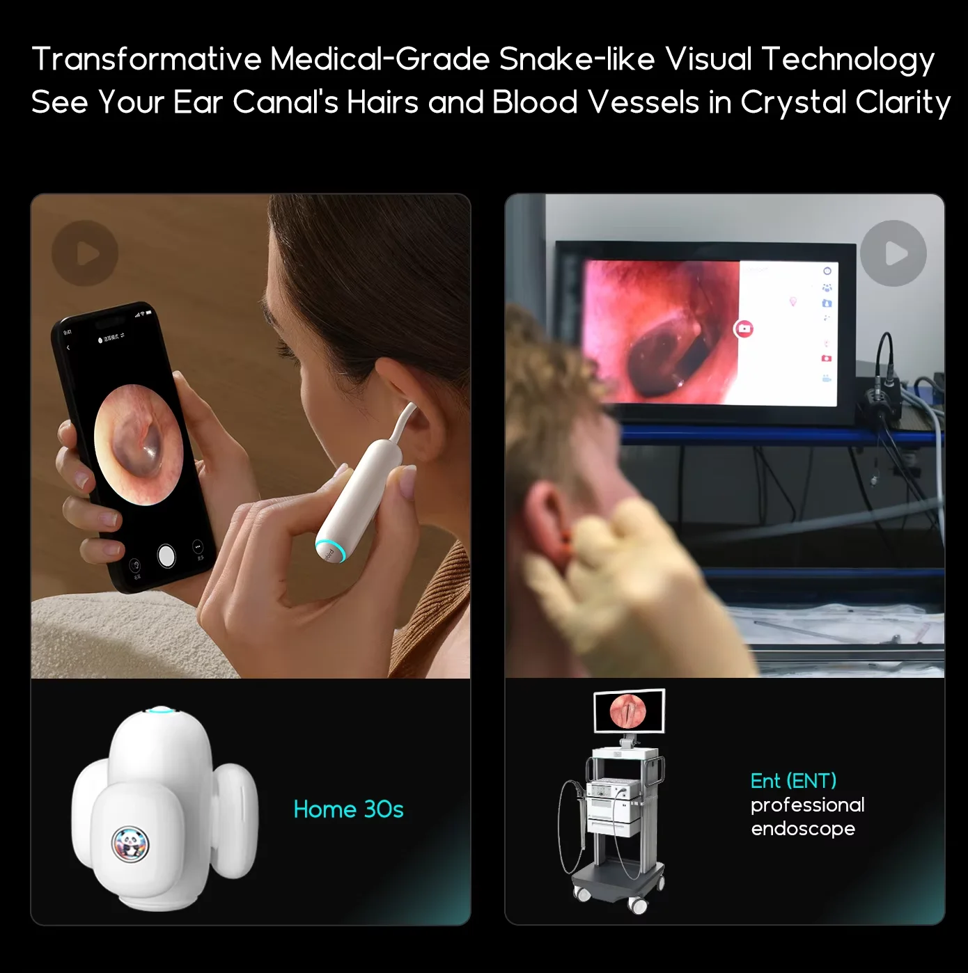 BEBIRD 2024 New Model Home 30S Visual Earwax Removal For Family Set Parent-Child Outfit Ear Otoscope AI Ear Care Assistant Kit 2
