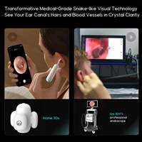 BEBIRD 2024 New Model Home 30S Visual Earwax Removal For Family Set Parent-Child Outfit Ear Otoscope AI Ear Care Assistant Kit 2